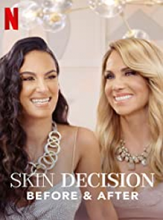 voir serie Skin Decision: Before and After en streaming
