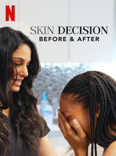 voir serie Skin Decision: Before and After saison 1